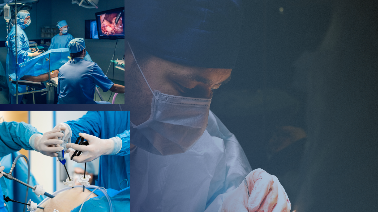 You are currently viewing Laparoscopic Cholecystectomy Surgeon Kolkata